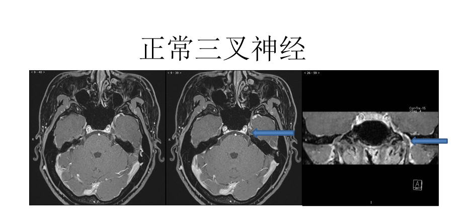 1688790809834214.png 微信图片_20230708123120.png